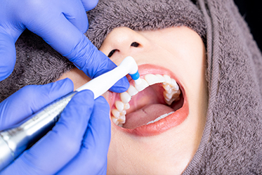 2.歯の表面のクリーニング